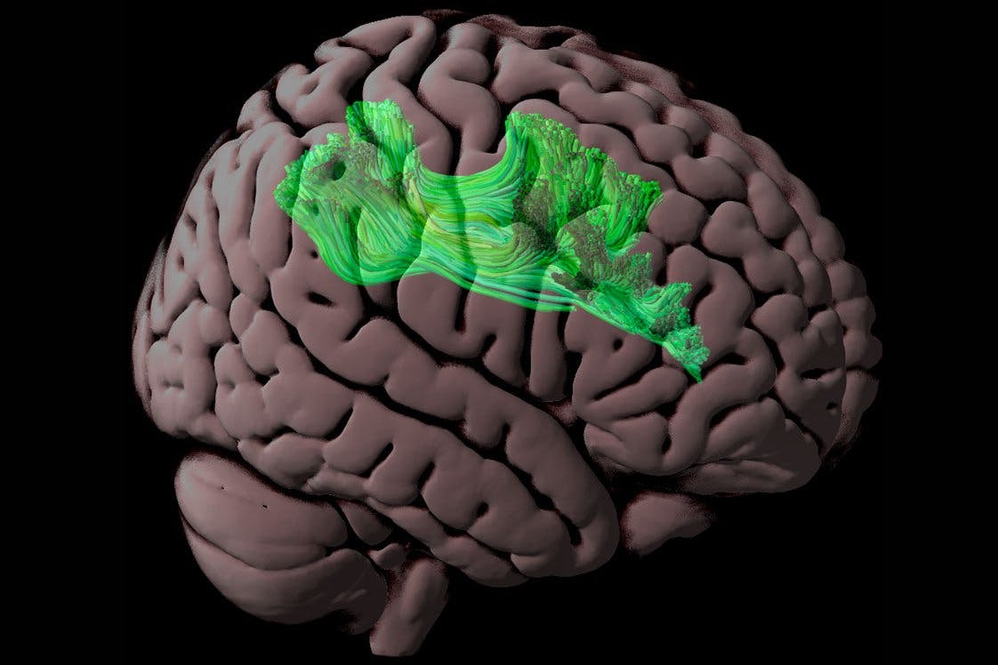 areas-modelo-3-cerebros